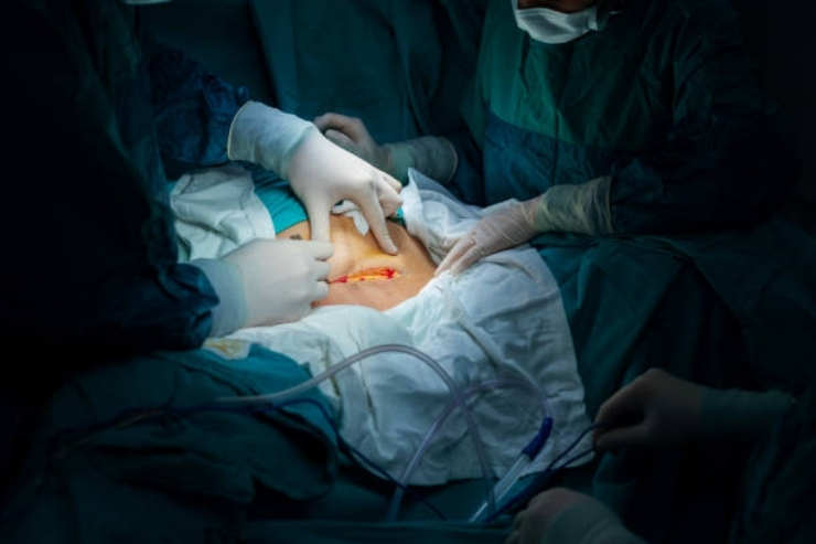 Urethral & Reconstructive Surgery-------20